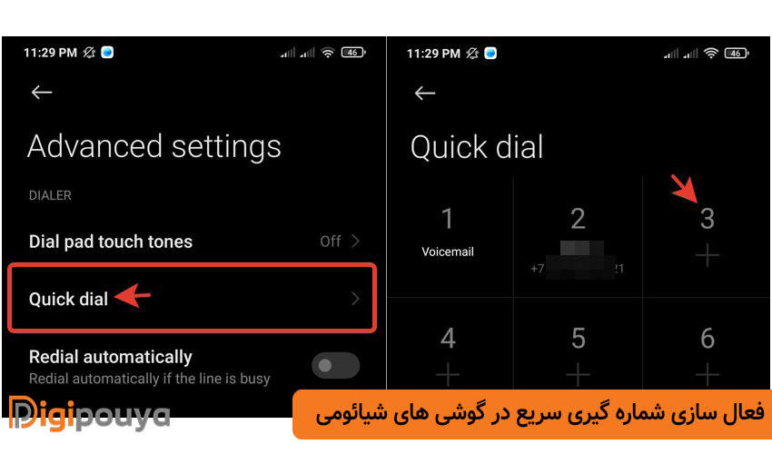 نحوه فعال سازی شماره گیری سریع در گوشی های شیائومی